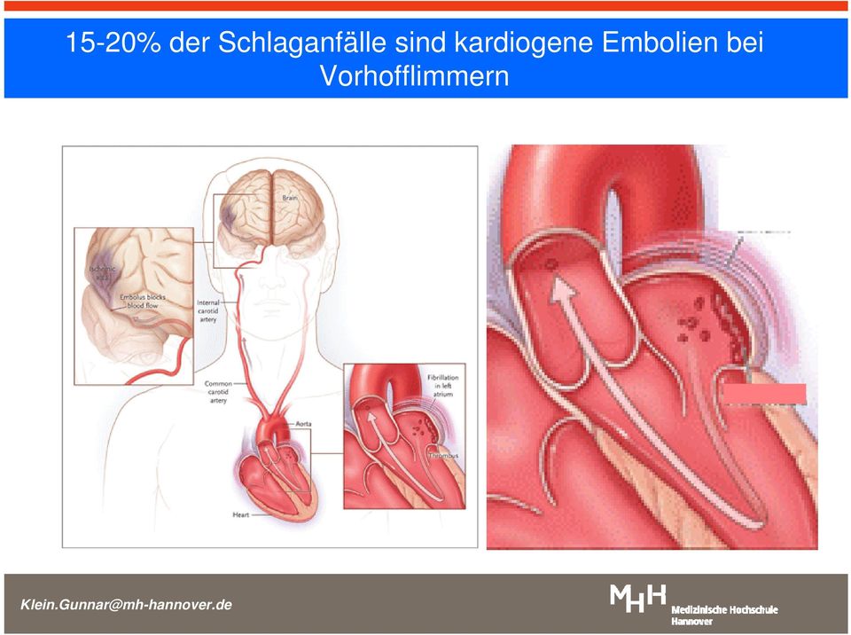 sind kardiogene