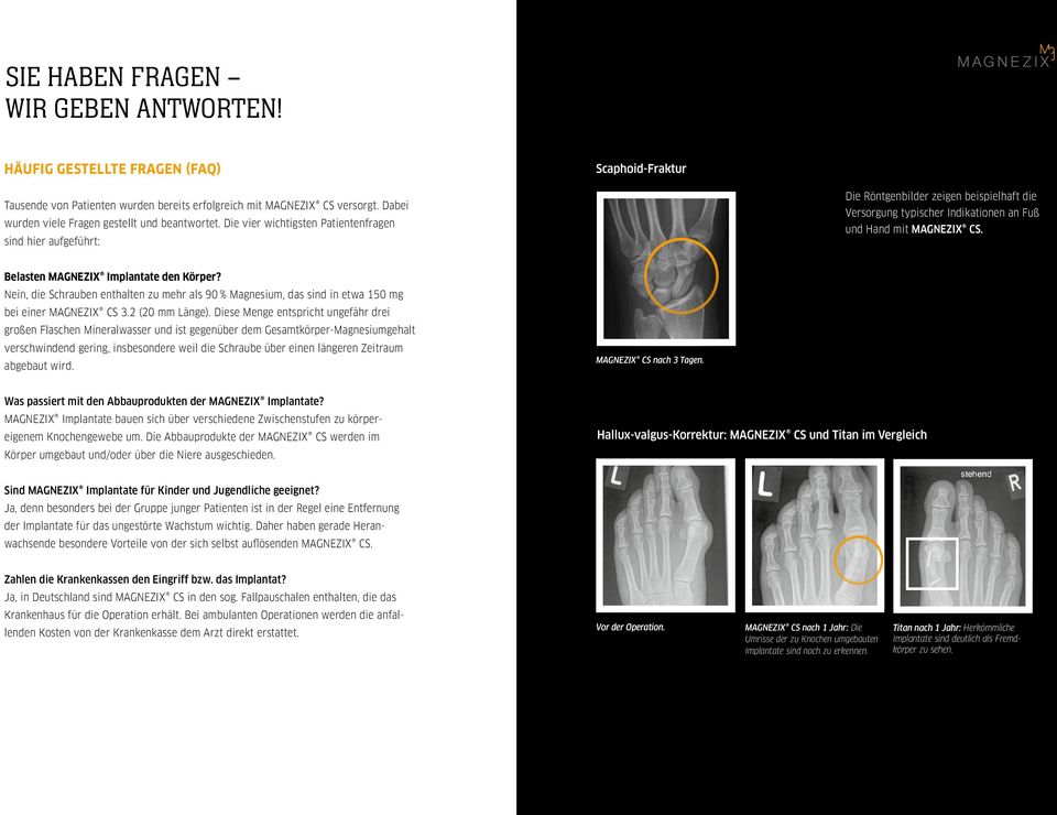 Die vier wichtigsten Patientenfragen sind hier aufgeführt: Die Röntgenbilder zeigen beispielhaft die Versorgung typischer Indikationen an Fuß und Hand mit MAGNEZIX CS.