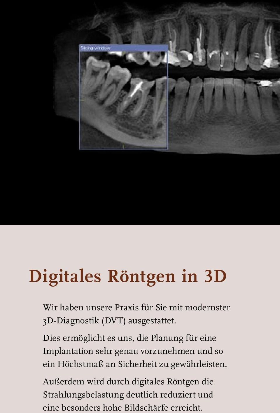 Dies ermöglicht es uns, die Planung für eine Implantation sehr genau vorzunehmen und so ein