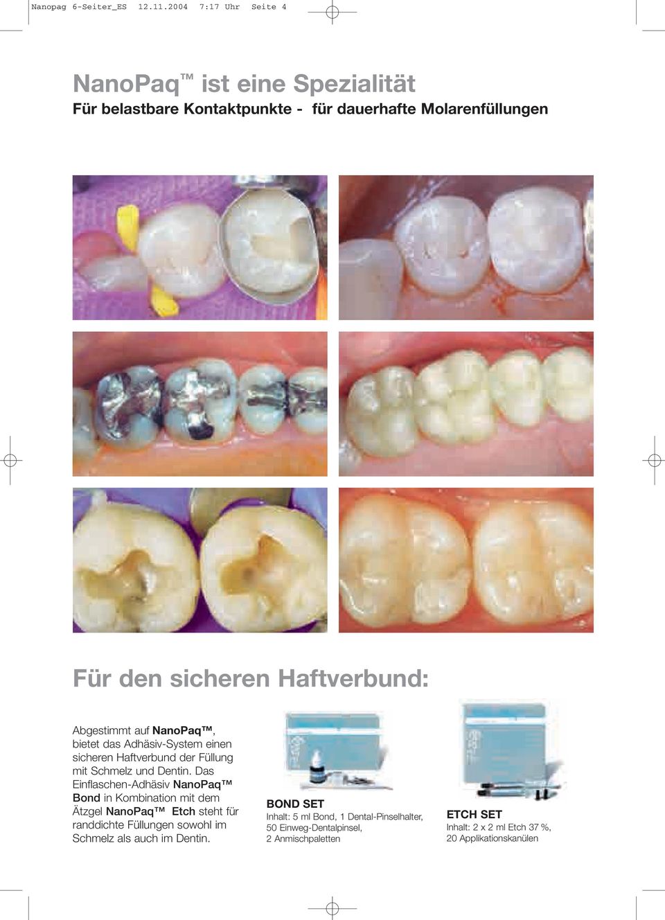 Abgestimmt auf, bietet das Adhäsiv-System einen sicheren Haftverbund der Füllung mit Schmelz und Dentin.