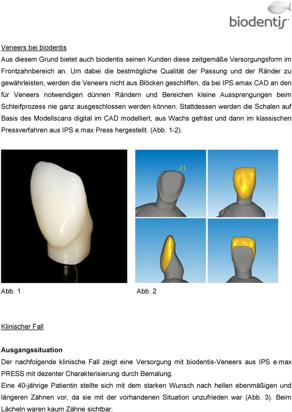 emax CAD an den für Veneers notwendigen dünnen Rändern und Bereichen kleine Aussprengungen beim Schleifprozess nie ganz ausgeschlossen werden können.