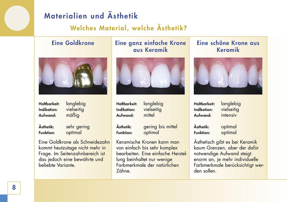 mittel Haltbarkeit: Indikation: Aufwand: langlebig vielseitig intensiv Ästhetik: Funktion: sehr gering optimal Ästhetik: Funktion: gering bis mittel optimal Ästhetik: Funktion: optimal optimal Eine