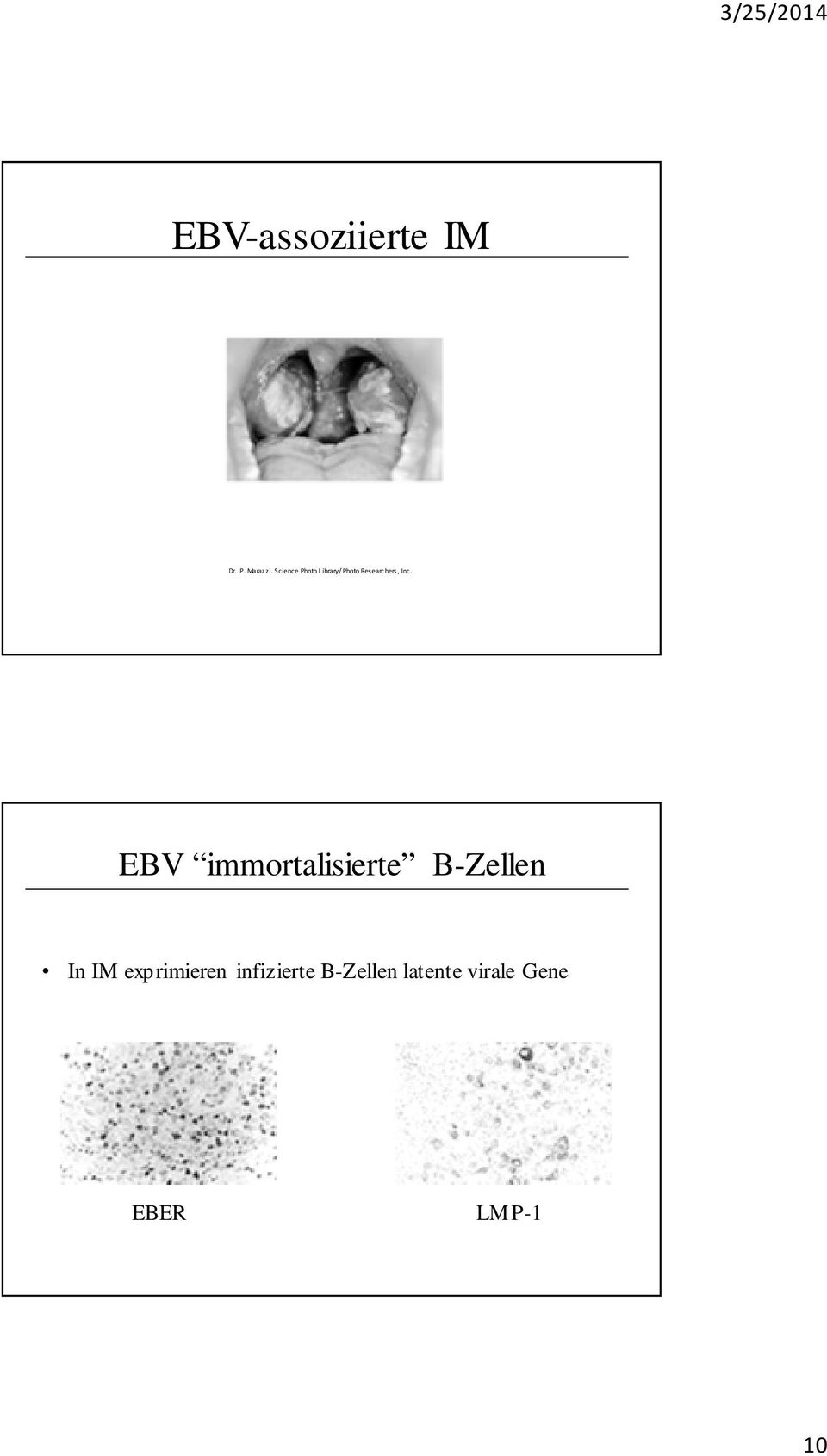 EBV immortalisierte B-Zellen In IM