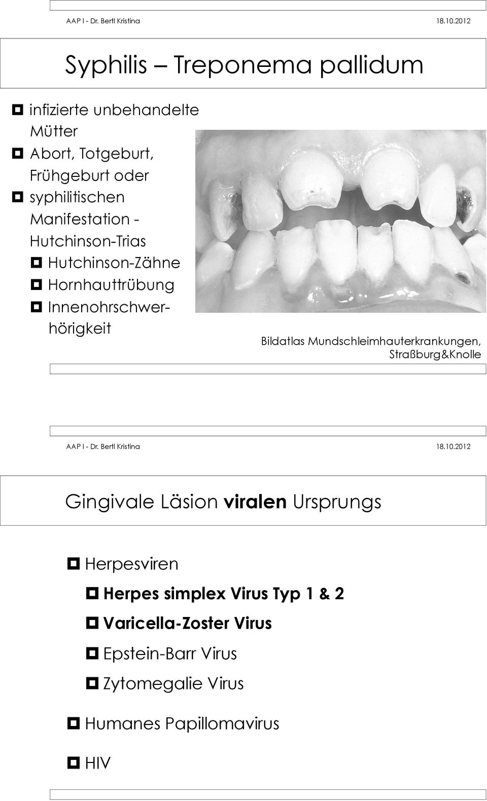 Innenohrschwerhörigkeit Bildatlas Mundschleimhauterkrankungen, Gingivale Läsion viralen Ursprungs!