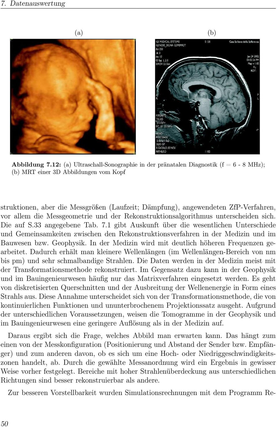 vor allem die Messgeometrie und der Rekonstruktionsalgorithmus unterscheiden sich. Die auf S.33 angegebene Tab. 7.