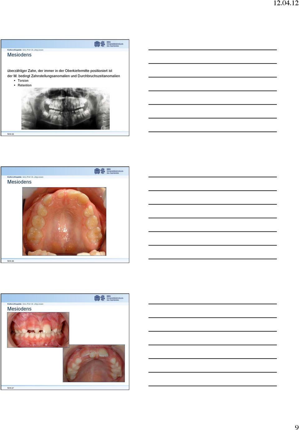 positioniert ist der M. bedingt Zahnstellungsanomalien und Durchbruchszeitanomalien!