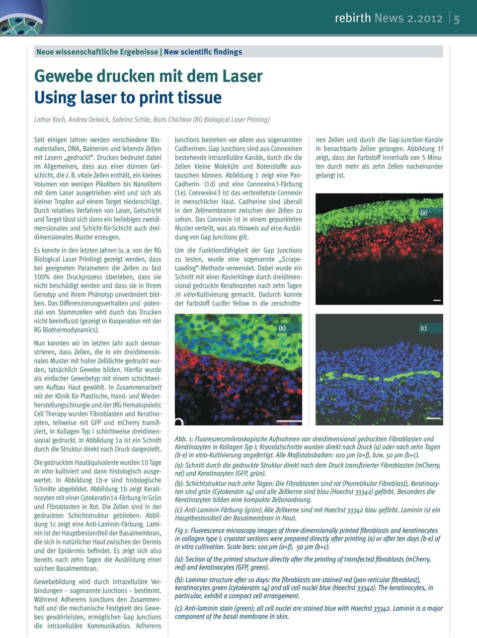 Laser Printing) Seit einigen Jahren werden verschiedene Biomaterialien, DNA, Bakterien und lebende Zellen mit Lasern gedruckt.