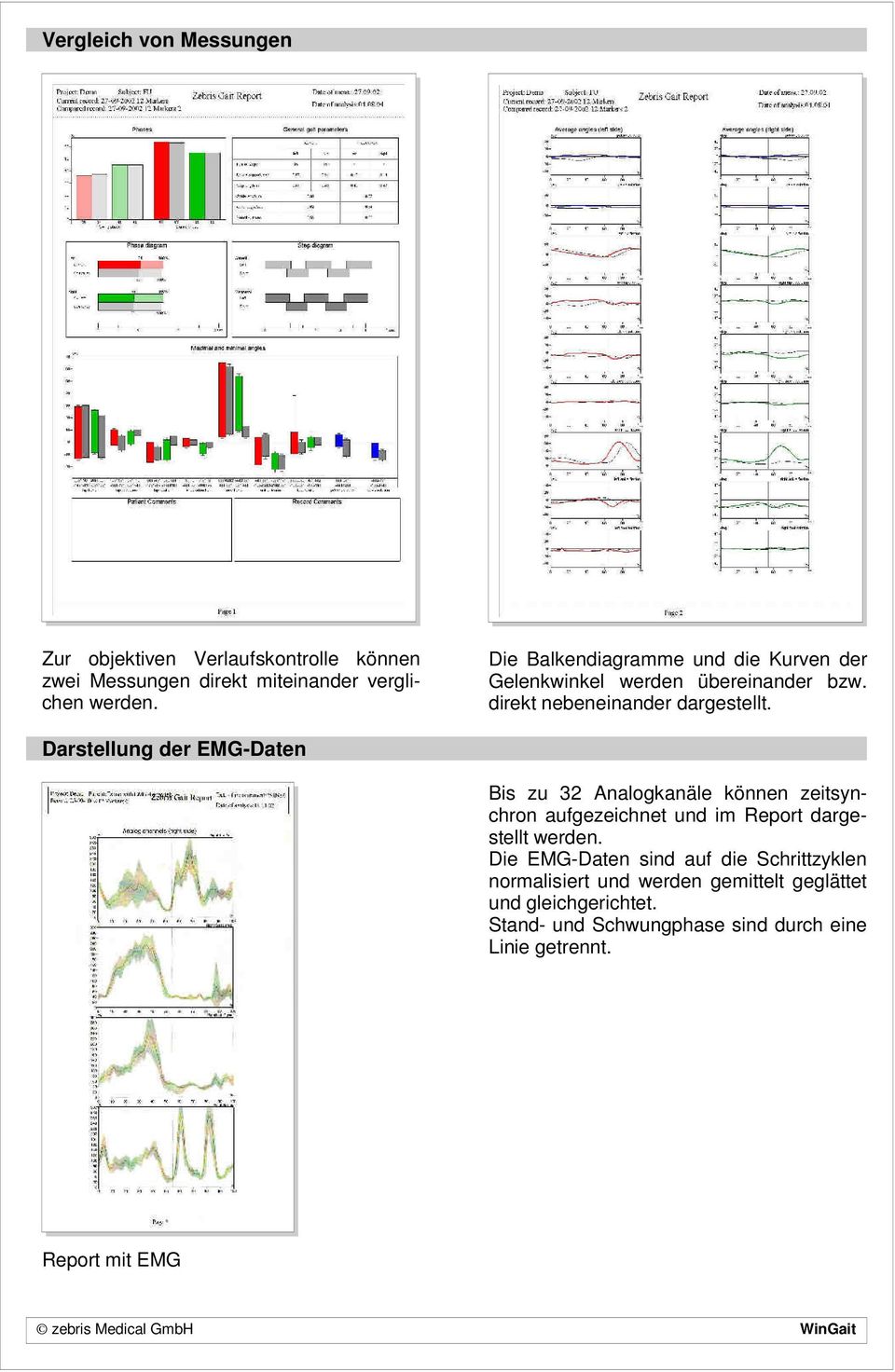 Darstellung der EMG-Daten Bis zu 32 Analogkanäle können zeitsynchron aufgezeichnet und im Report dargestellt Die EMG-Daten sind auf