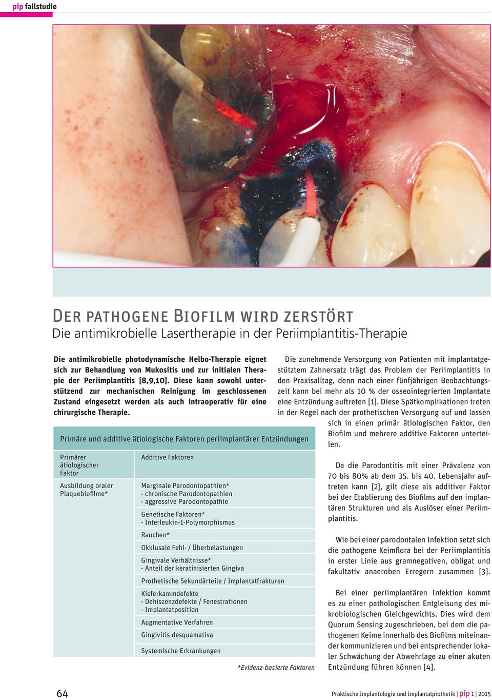 Diese kann sowohl unterstützend zur mechanischen Reinigung im geschlossenen Zustand eingesetzt werden als auch intraoperativ für eine chirurgische Therapie.