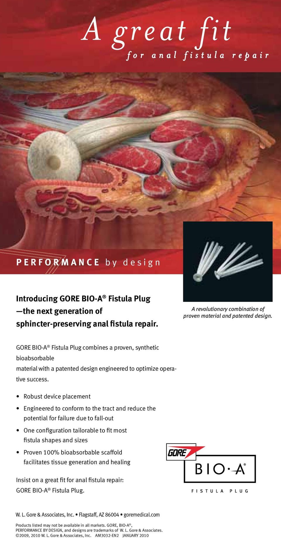 GORE BIO-A Fistula Plug combines a proven, synthetic bioabsorbable material with a patented design engineered to optimize operative success.