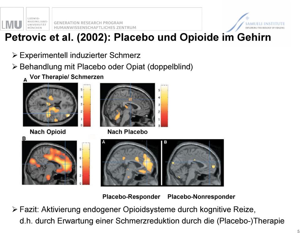Placebo oder Opiat (doppelblind) Vor Therapie/ Schmerzen Nach Opioid Nach Placebo