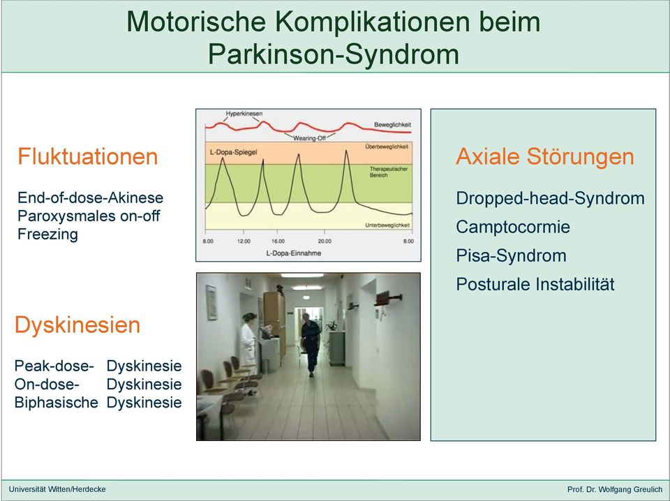 Dropped-head-Syndrom Camptocormie Pisa-Syndrom Posturale