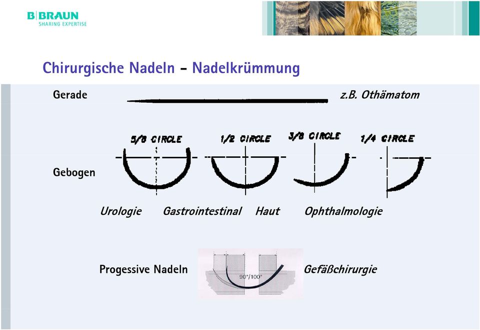 Othämatom Gebogen Urologie