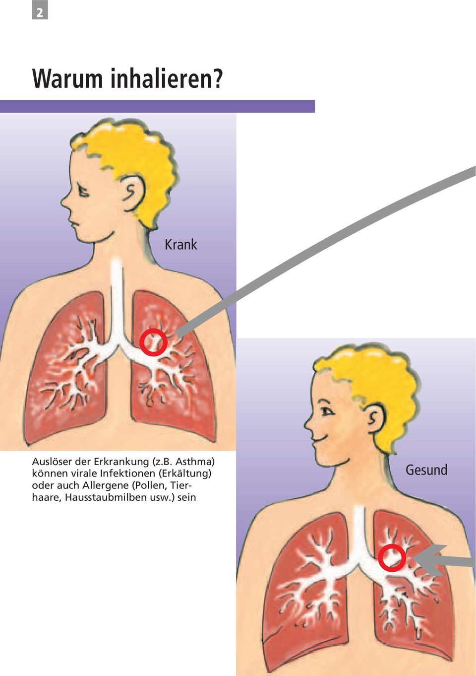 Asthma) können virale Infektionen