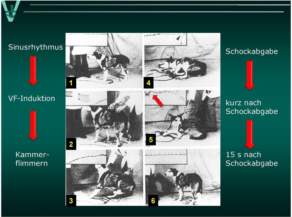 Schockabgabe Kammerflimmern