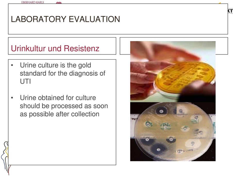 diagnosis of UTI Urine obtained for culture