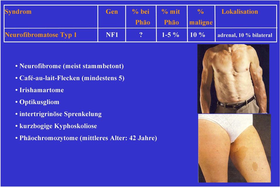 1-5 % 10 % adrenal, 10 % bilateral Neurofibrome (meist stammbetont)