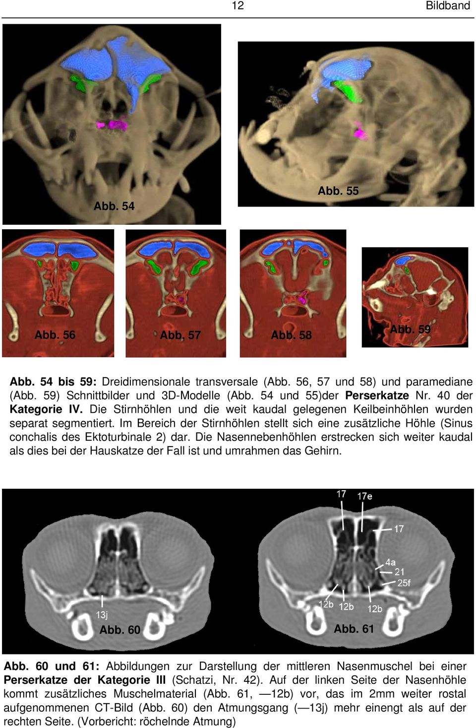 Im Bereich der Stirnhöhlen stellt sich eine zusätzliche Höhle (Sinus conchalis des Ektoturbinale 2) dar.
