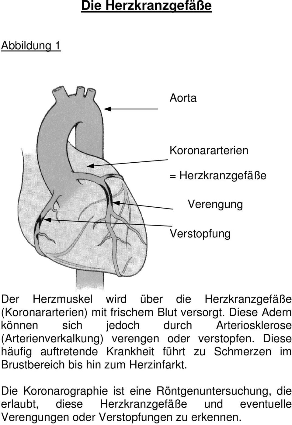 Diese Adern können sich jedoch durch Arteriosklerose (Arterienverkalkung) verengen oder verstopfen.