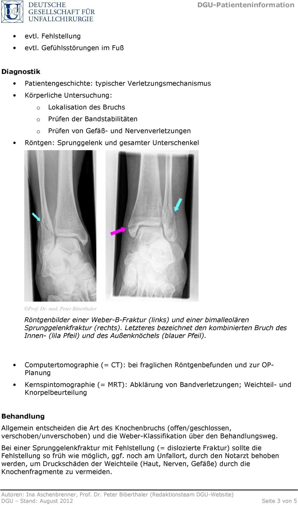 Nervenverletzungen Röntgen: Sprunggelenk und gesamter Unterschenkel Prf. Dr. med. Peter Biberthaler Röntgenbilder einer Weber-B-Fraktur (links) und einer bimallelären Sprunggelenkfraktur (rechts).