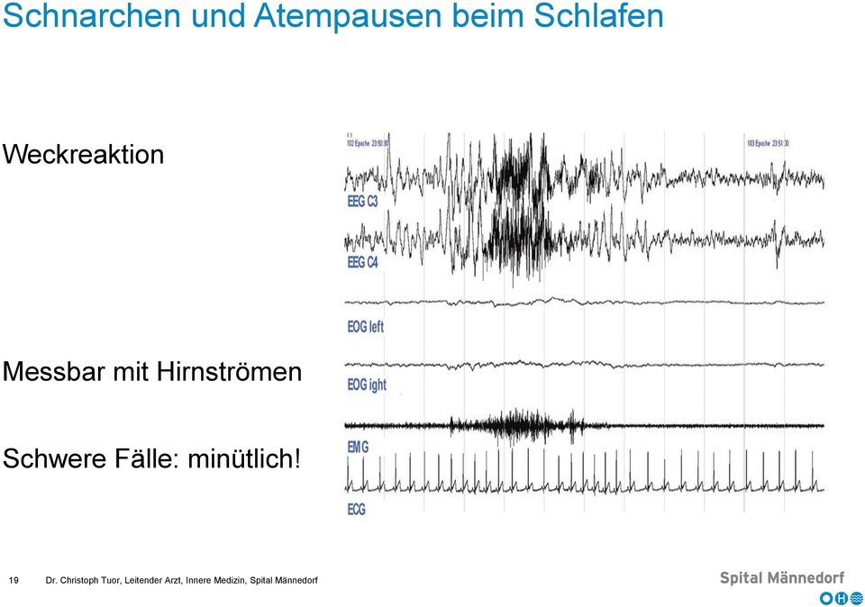 Schwere Fälle: minütlich! 19 Dr.