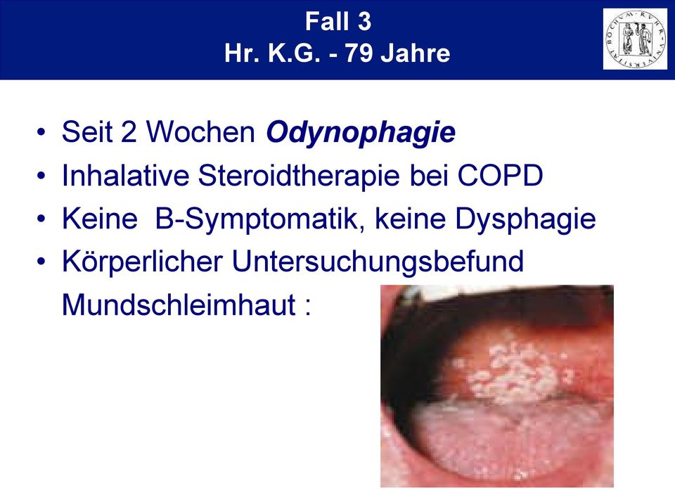 Inhalative Steroidtherapie bei COPD Keine