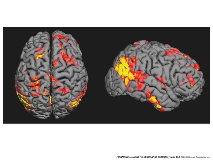 Konnektivitätsanalysen Ziel: zu verstehen, wie Hirnregionen untereinander verbunden sind,