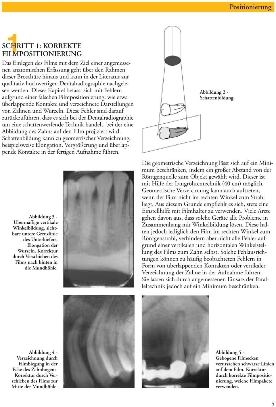 Dieses Kapitel befasst sich mit Fehlern aufgrund einer falschen Filmpositionierung, wie etwa überlappende Kontakte und verzeichnete Darstellungen von Zähnen und Wurzeln.