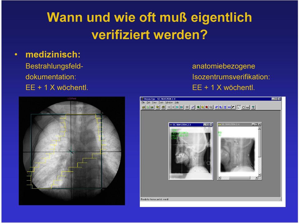 medizinisch: Bestrahlungsfelddokumentation: