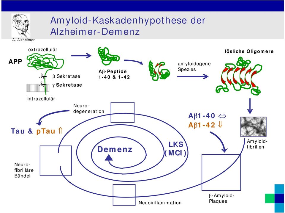 amyloidogene Spezies intrazellulär Tau & ptau Neurodegeneration Aβ1-40 Aβ1-42