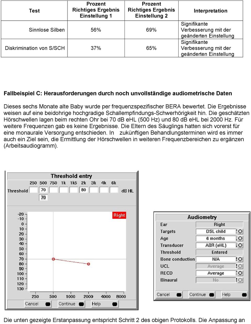 per frequenzspezifischer BERA bewertet. Die Ergebnisse weisen auf eine beidohrige hochgradige Schallempfindungs-Schwerhörigkeit hin.