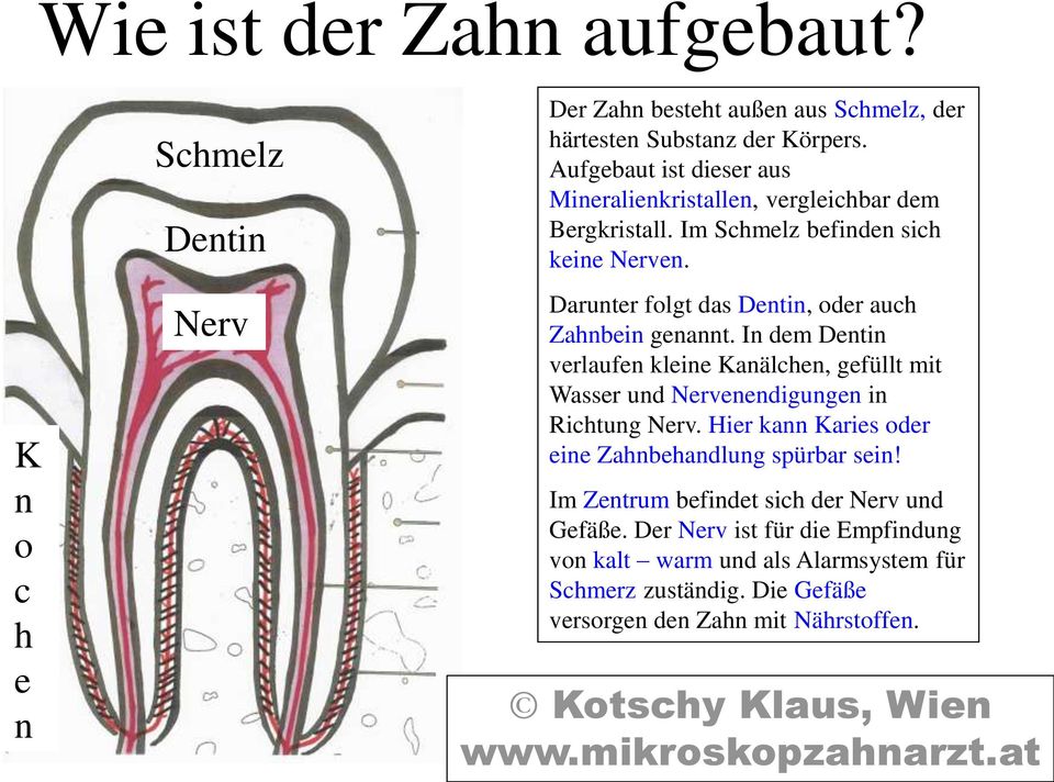 Darunter folgt das Dentin, oder auch Zahnbein genannt. In dem Dentin verlaufen kleine Kanälchen, gefüllt mit Wasser und Nervenendigungen in Richtung Nerv.