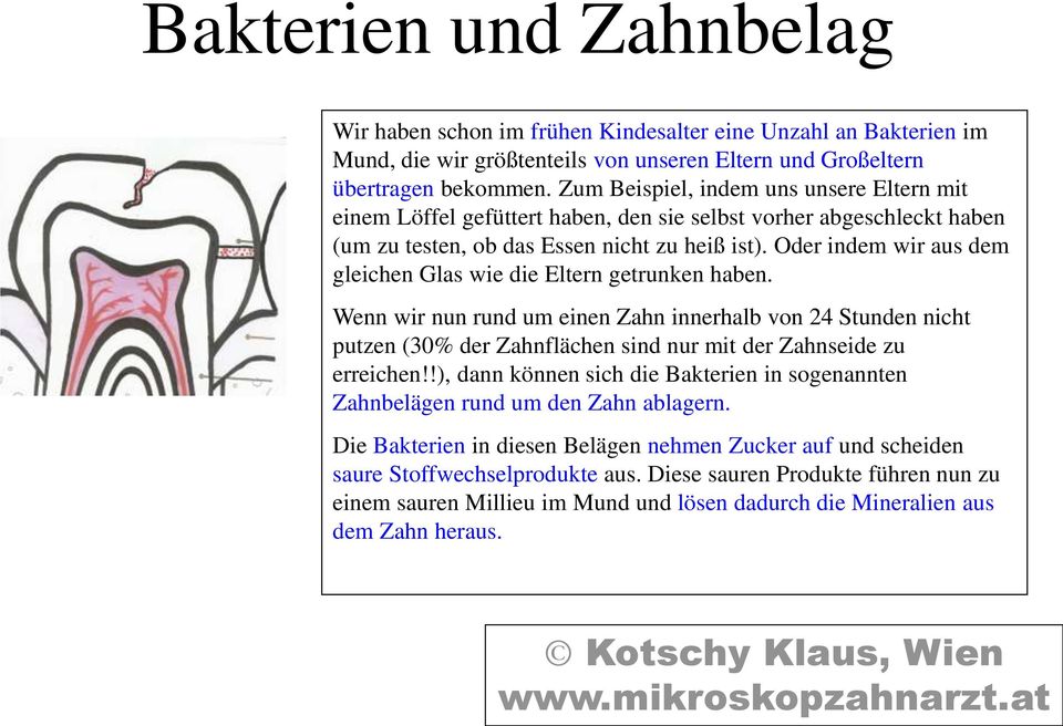 Oder indem wir aus dem gleichen Glas wie die Eltern getrunken haben. Wenn wir nun rund um einen Zahn innerhalb von 24 Stunden nicht putzen (30% der Zahnflächen sind nur mit der Zahnseide zu erreichen!