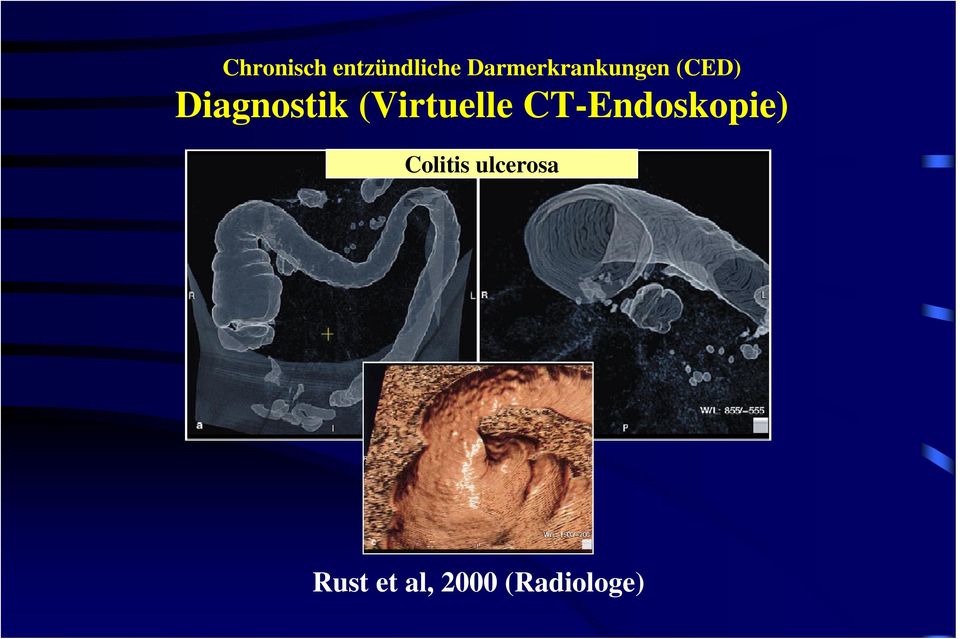 CT-Endoskopie)