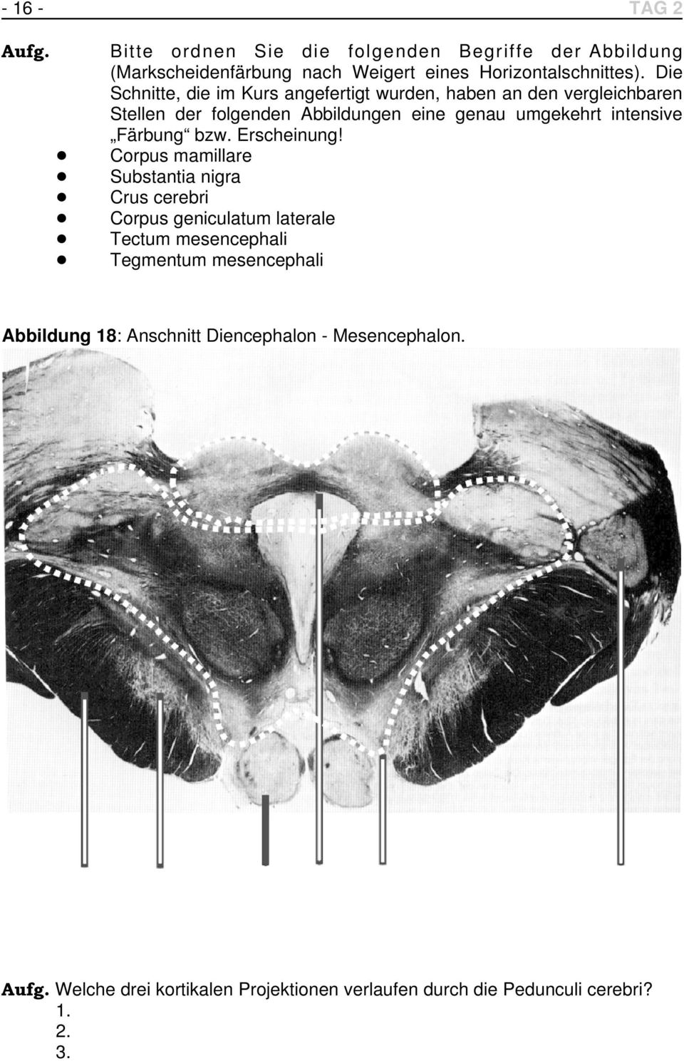 Färbung bzw. Erscheinung!! Corpus mamillare! Substantia nigra! Crus cerebri! Corpus geniculatum laterale! Tectum mesencephali!
