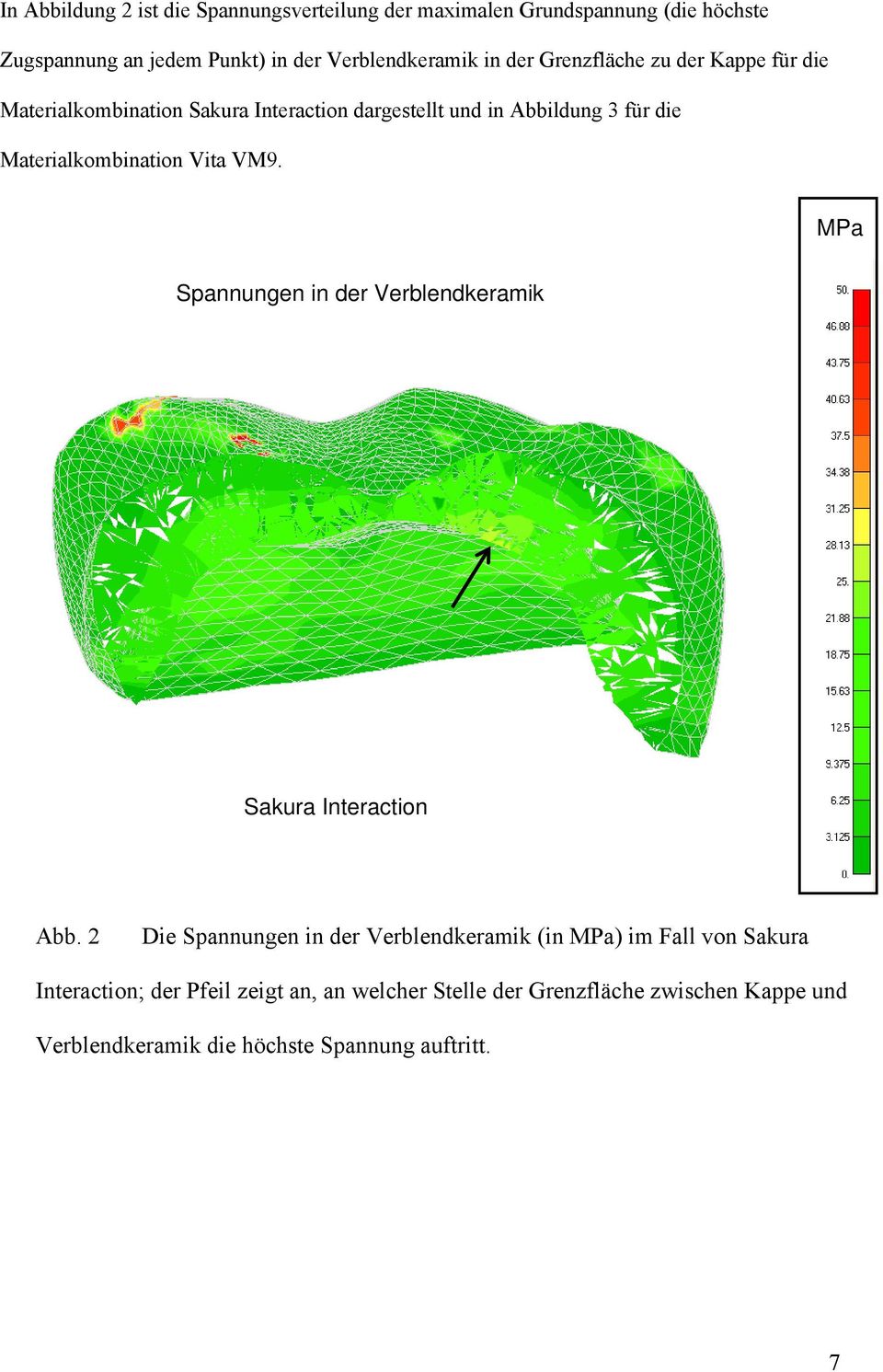 Materialkombination Vita VM9. MPa Spannungen in der Verblendkeramik Sakura Interaction Abb.
