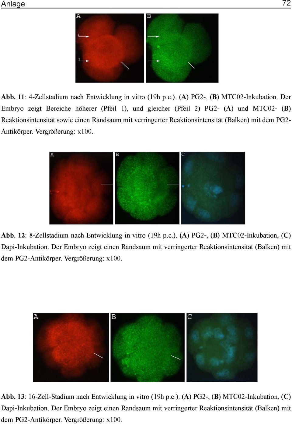 Antikörper. Vergrößerung: x100. Abb. 12: 8-Zellstadium nach Entwicklung in vitro (19h p.c.). (A) PG2-, (B) MTC02-Inkubation, (C) Dapi-Inkubation.