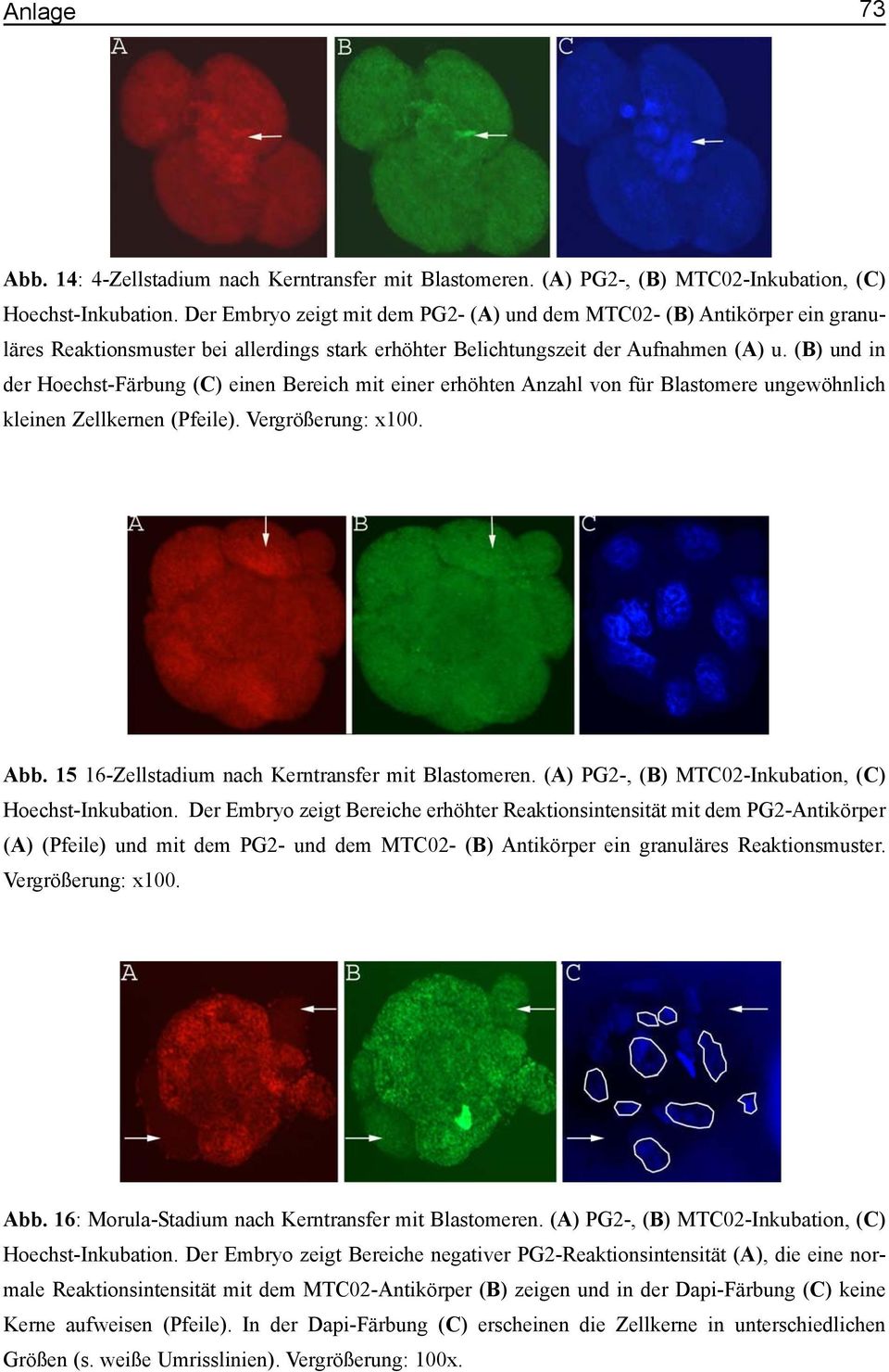 (B) und in der Hoechst-Färbung (C) einen Bereich mit einer erhöhten Anzahl von für Blastomere ungewöhnlich kleinen Zellkernen (Pfeile). Vergrößerung: x100. Abb.