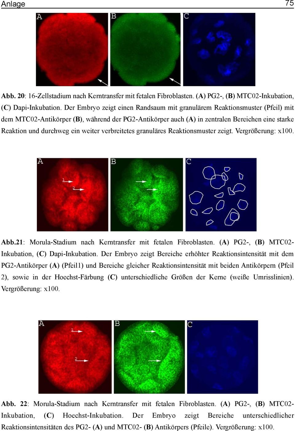 weiter verbreitetes granuläres Reaktionsmuster zeigt. Vergrößerung: x100. Abb.21: Morula-Stadium nach Kerntransfer mit fetalen Fibroblasten. (A) PG2-, (B) MTC02- Inkubation, (C) Dapi-Inkubation.