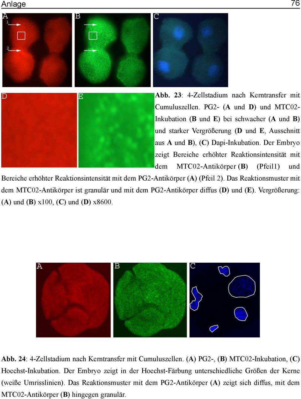 Der Embryo zeigt Bereiche erhöhter Reaktionsintensität mit dem MTC02-Antikörper (B) (Pfeil1) und Bereiche erhöhter Reaktionsintensität mit dem PG2-Antikörper (A) (Pfeil 2).