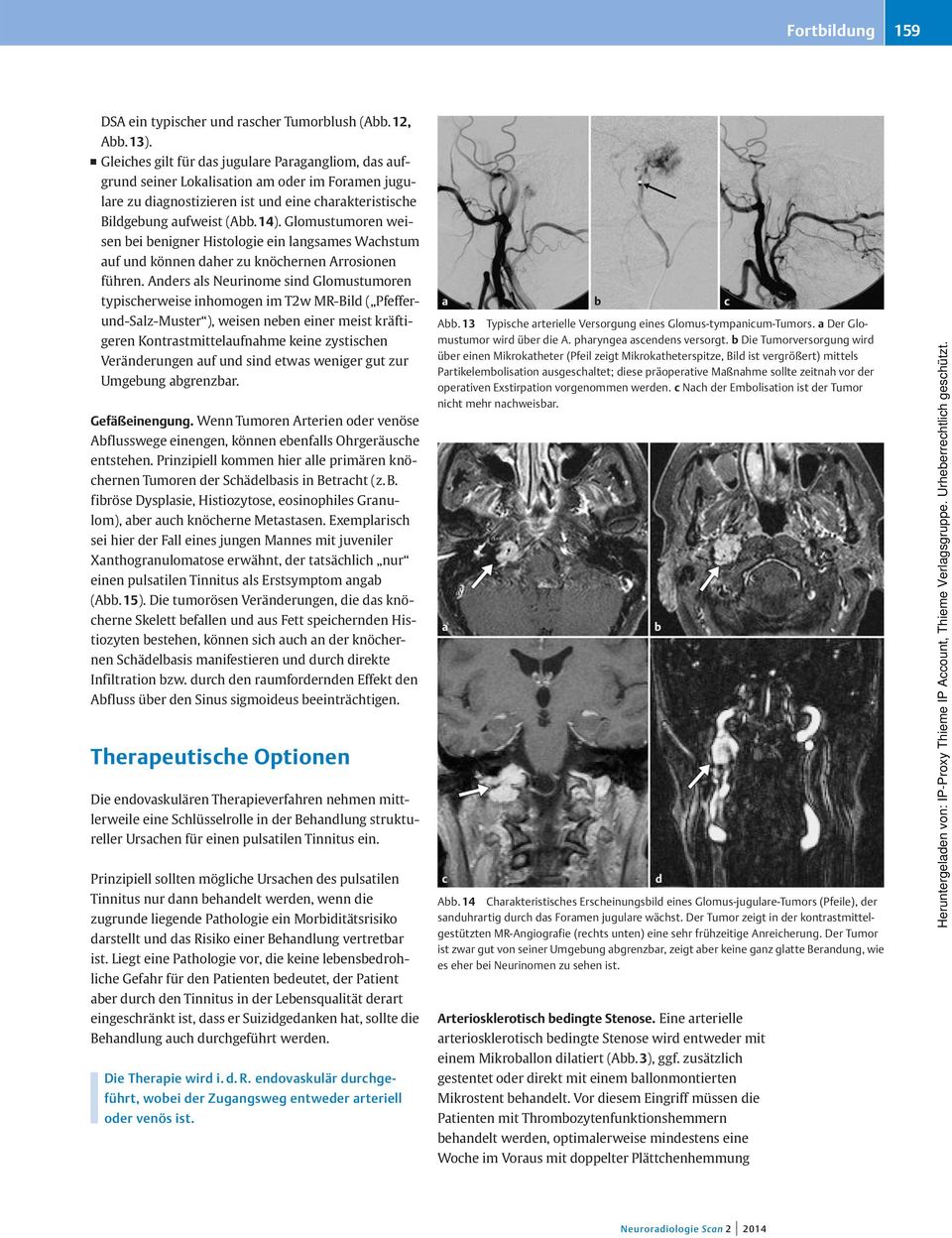 Glomustumoren weisen bei benigner Histologie ein langsames Wachstum auf und können daher zu knöchernen rrosionen führen.