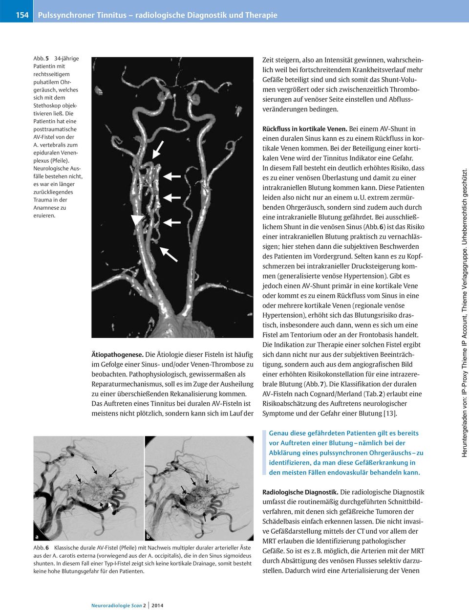 Neurologische usfälle bestehen nicht, es war ein länger zurückliegendes Trauma in der namnese zu eruieren. Ätiopathogenese.