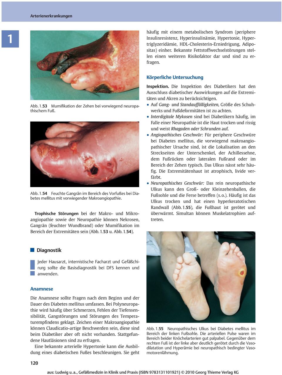 .53 Mumifikation der Zehen bei vorwiegend neuropathischem Fuß. Abb..54 Feuchte Gangrän im Bereich des Vorfußes bei Diabetes mellitus mit vorwiegender Makroangiopathie.