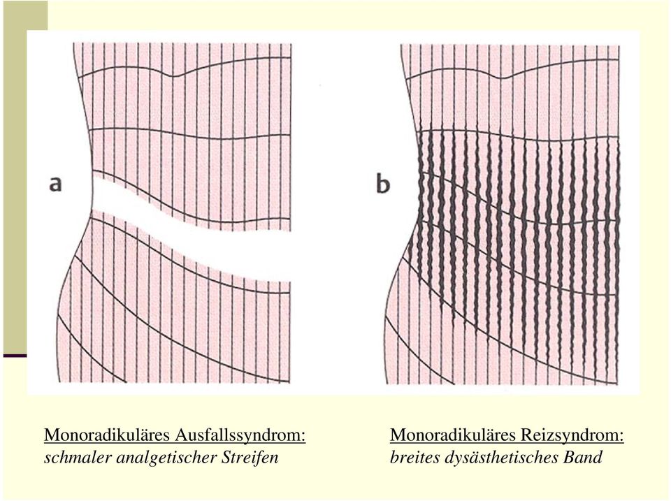 analgetischer Streifen 