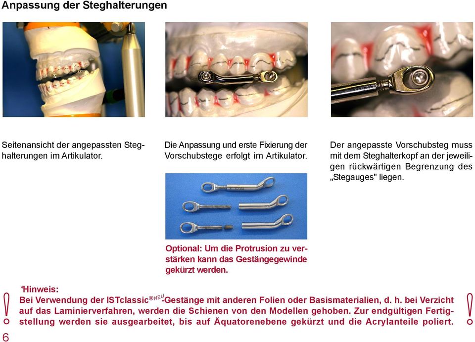 " Optional: Um die Protrusion zu verstärken kann das Gestängegewinde gekürzt werden.