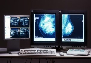 Workflow - Digitale Mammografie Akquisition