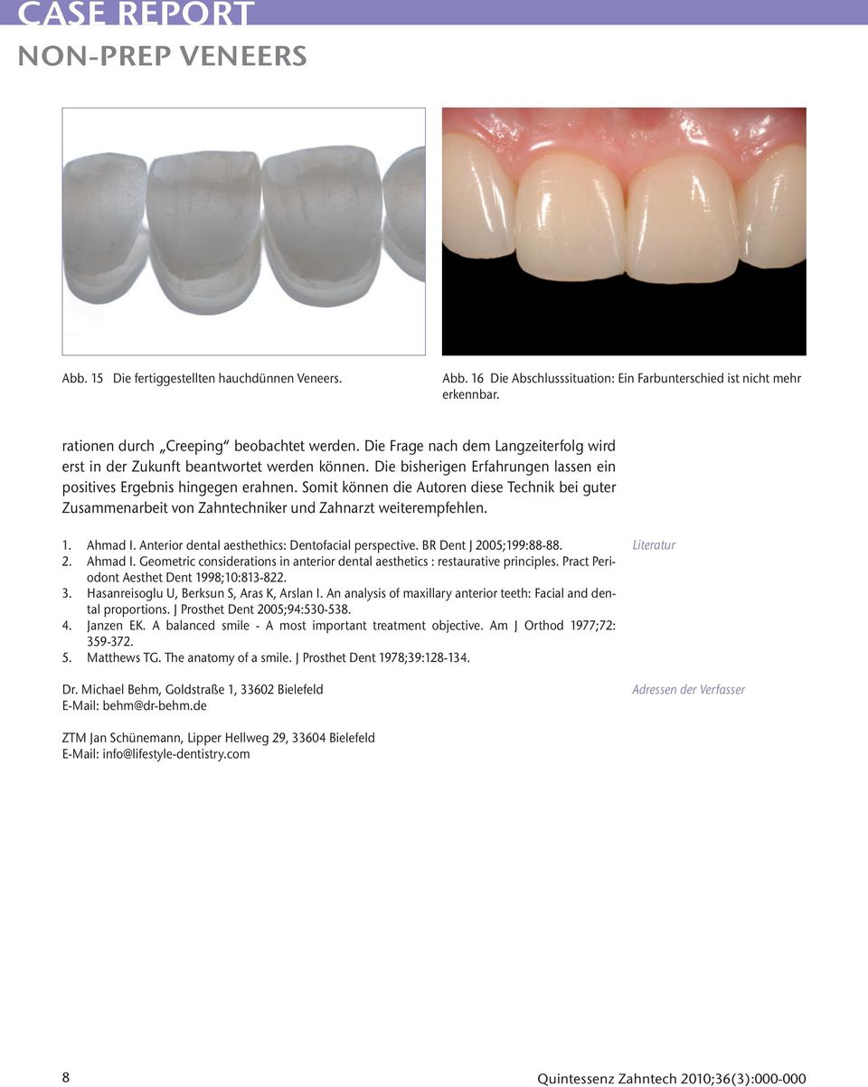 Somit können die Autoren diese Technik bei guter Zusammenarbeit von Zahntechniker und Zahnarzt weiterempfehlen. 1. Ahmad I. Anterior dental aesthethics: Dentofacial perspective.