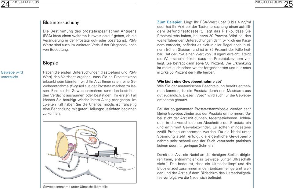 Biopsie Haben die ersten Untersuchungen (Tastbefund und PSA- Wert) den Verdacht ergeben, dass Sie an Prostatakrebs erkrankt sein könnten, wird Ihr Arzt Ihnen raten, eine Gewebeentnahme (Biopsie) aus