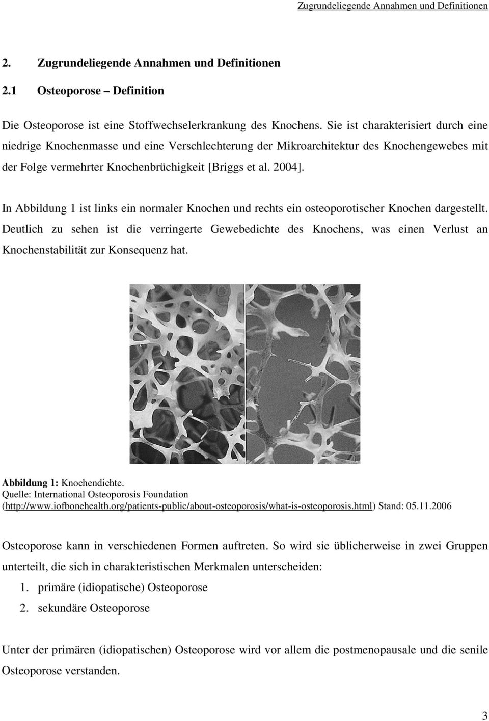 In Abbildung 1 ist links ein normaler Knochen und rechts ein osteoporotischer Knochen dargestellt.