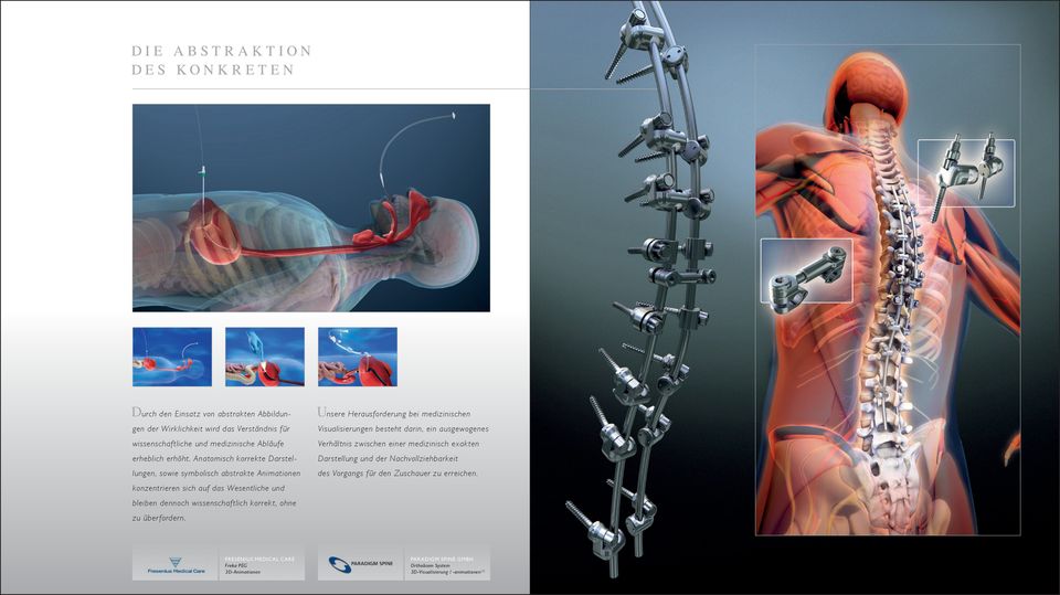 Anatomisch korrekte Darstel- Darstellung und der Nachvollziehbarkeit lungen, sowie symbolisch abstrakte Animationen des Vorgangs f ür den Zuschauer zu erreichen.